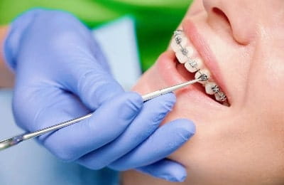 স্মাইল ডেন্টাল কেয়ারে সেবার পর সন্তুষ্ট রোগীর হাসি